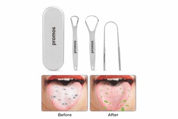 A tongue cleaning set featuring two stainless steel tools and a compact storage case, with before-and-after images of a tongue.